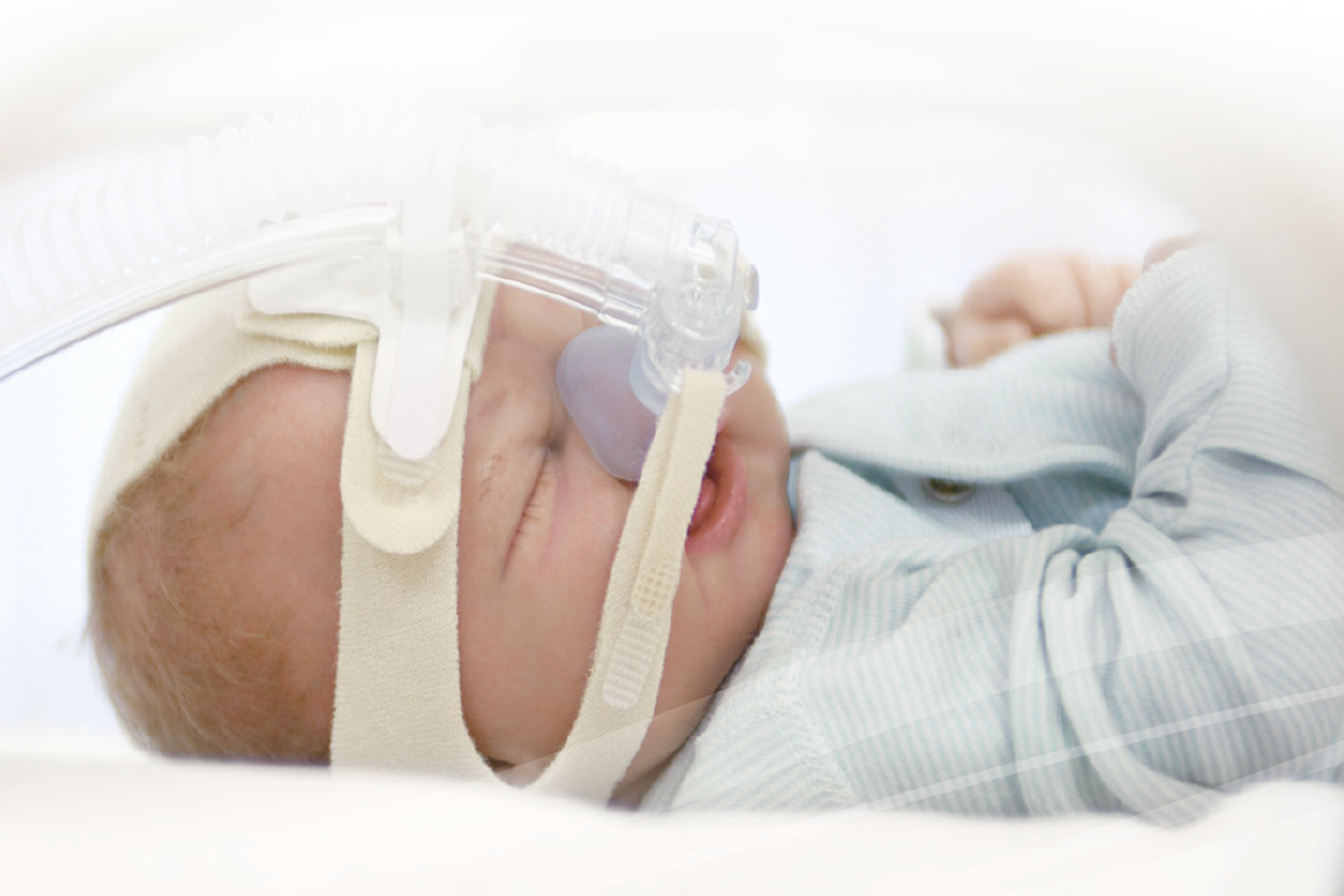 Neonatal Ventilation 
