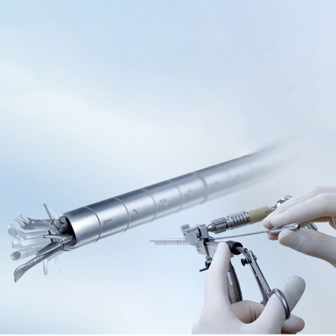 MINOP® InVent System