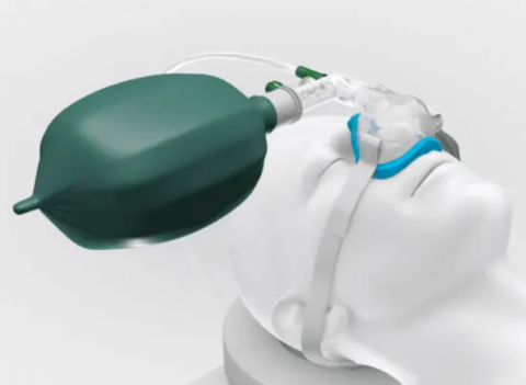 Nasal Positive Airway Pressure System with Hyperinflation Bag