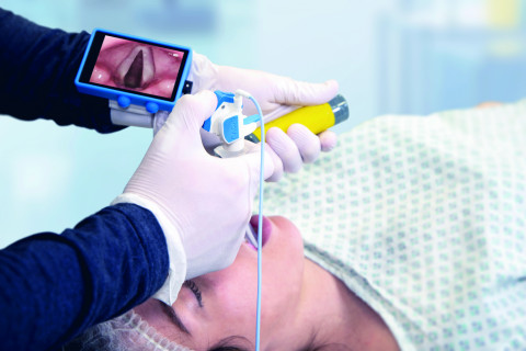 Video Stylet in Use During Intubation with Laryngoscope