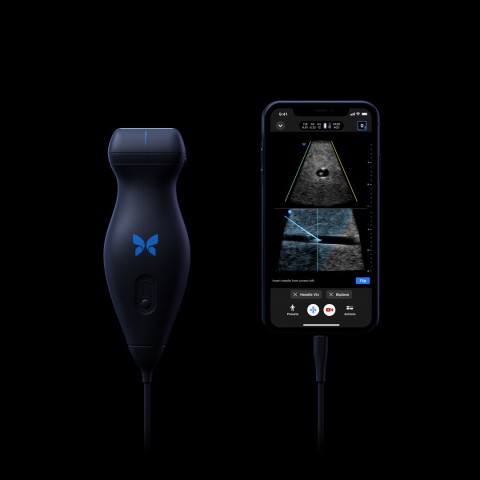 Butterfly Device Showing Diagnostic Image on Mobile Phone